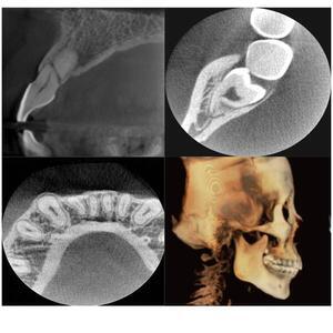 東白楽ハシビロ歯科クリニック　CT撮影　3DCT CBCT_コピー_コピー