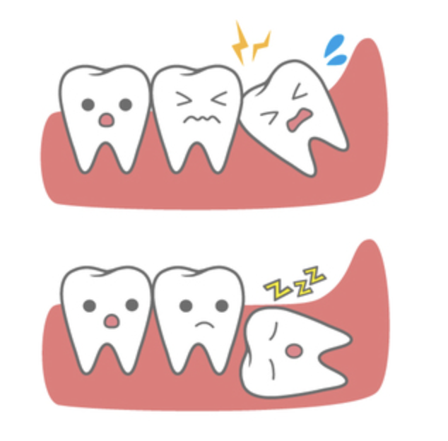 wisdomteeth