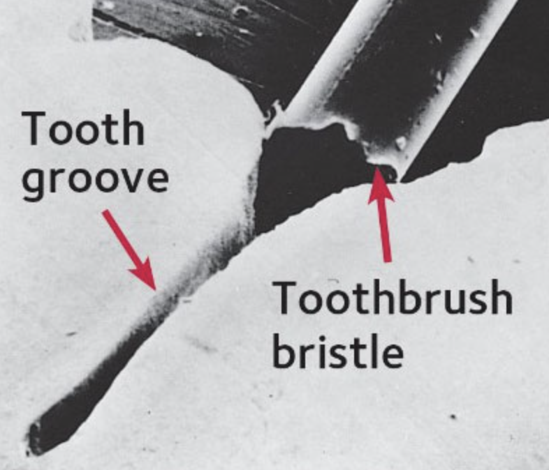 toothgroove